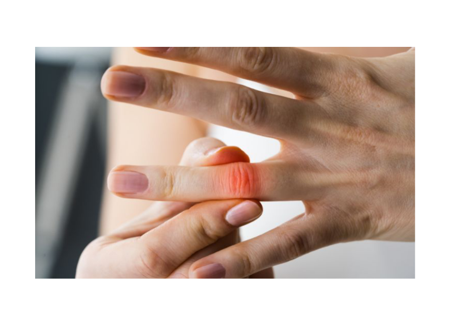 Treatment of Finger Pain